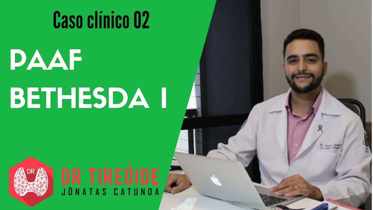 Nódulo na tireóide Bethesda I = Citologia Hemorrágica - Caso clínico | Dr Jônatas Catunda