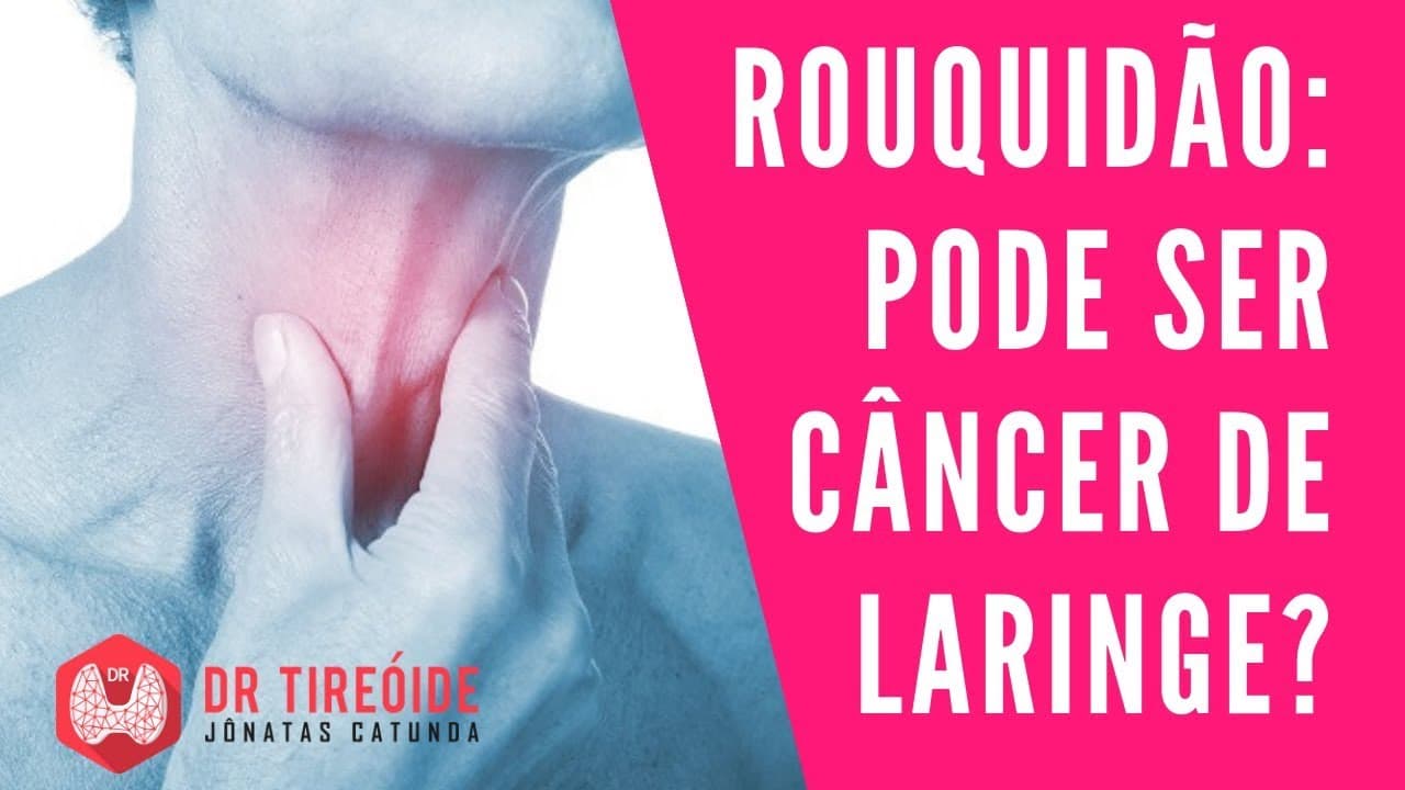 Rouquidão - Quando pensar em câncer de laringe? - Dr Jônatas Catunda
