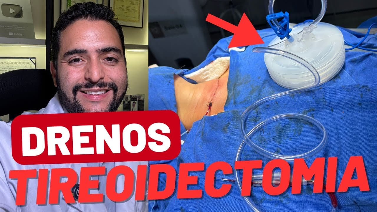 Cirurgia de tireoide: recuperação e quando usa dreno