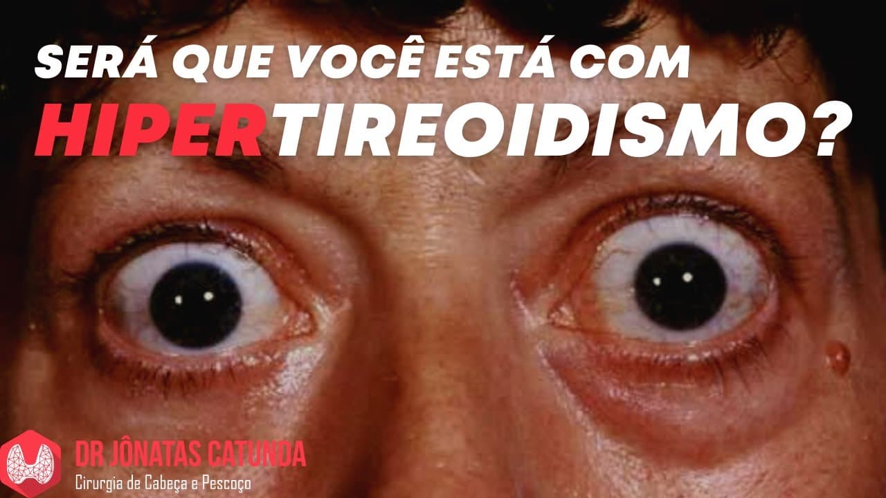 Sinais e sintomas que você está com HIPERTIREOIDISMO