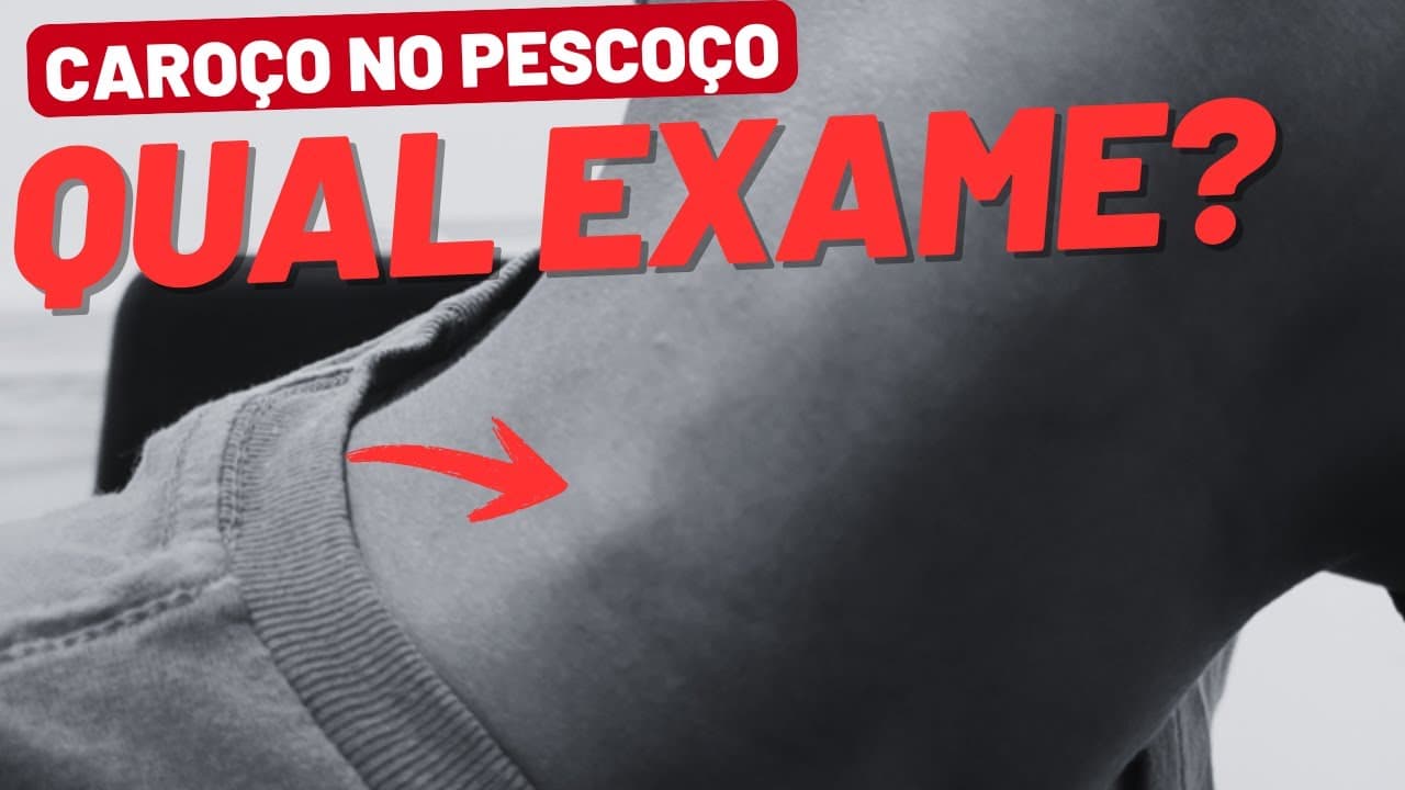 Caroço no pescoço: quais exames fazer e quando