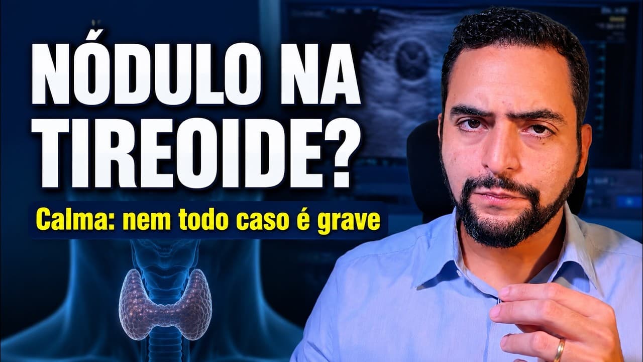 Descobri um nódulo na tireoide: é câncer? Preciso operar?
