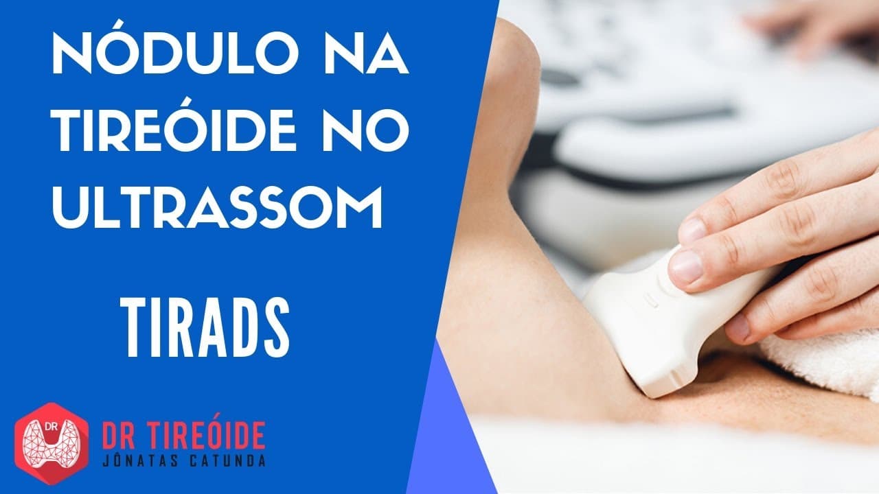 Classificação de TIRADS dos nódulos da tireóide no Ultrassom - Dr Tireóide responde
