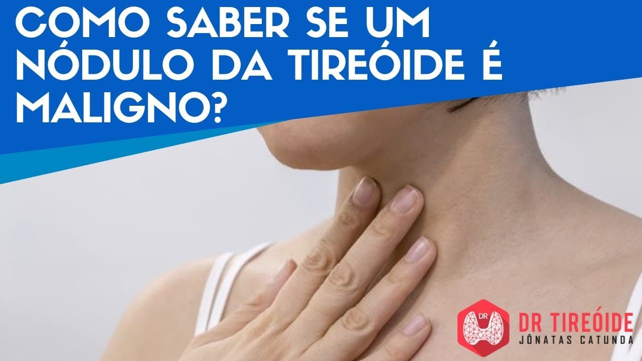 Como saber se um nódulo da tireóide é maligno? - Dr Tireóide Responde