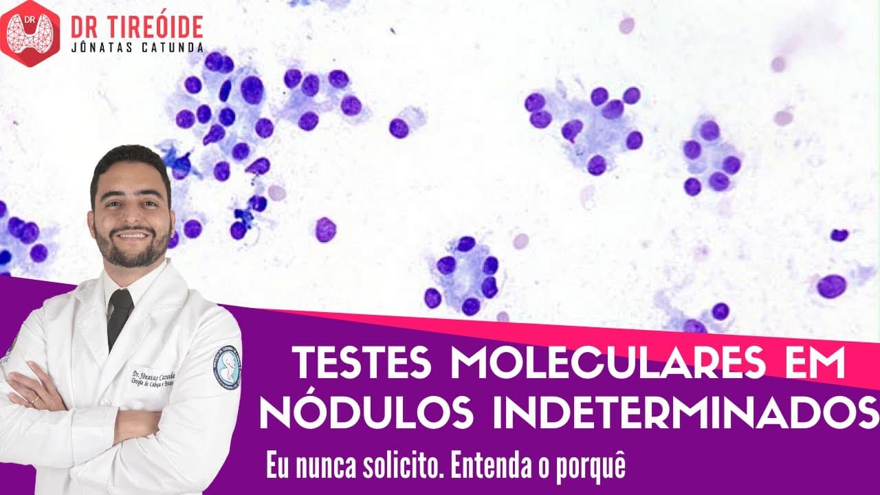 Testes moleculares em nódulos indeterminados na PAAF da tireóide - LIVE