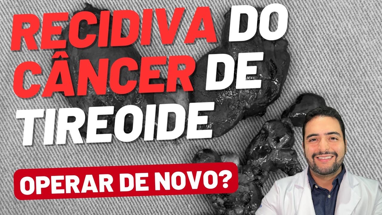 Recidiva do Câncer de Tireoide: sempre precisa operar de novo?