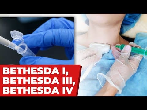 Resultado Bethesda I, III ou IV da punção da tireoide - Indeterminado. E agora?