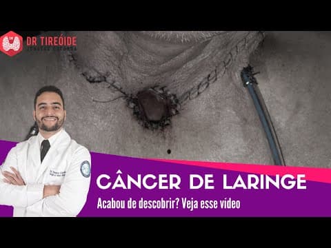 Câncer de laringe - Vídeo para quem acabou de descobrir! | Dr Jônatas Catunda