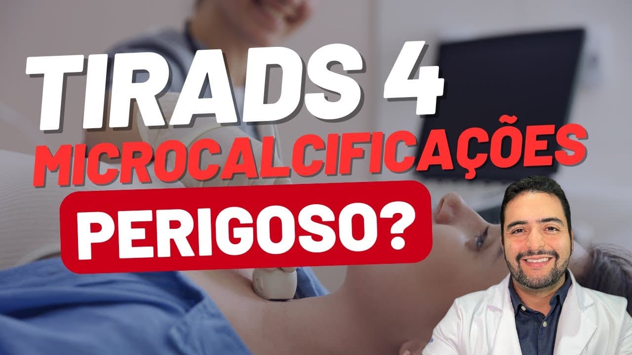 TIRADS 4 com microcalcificações: devo me preocupar?