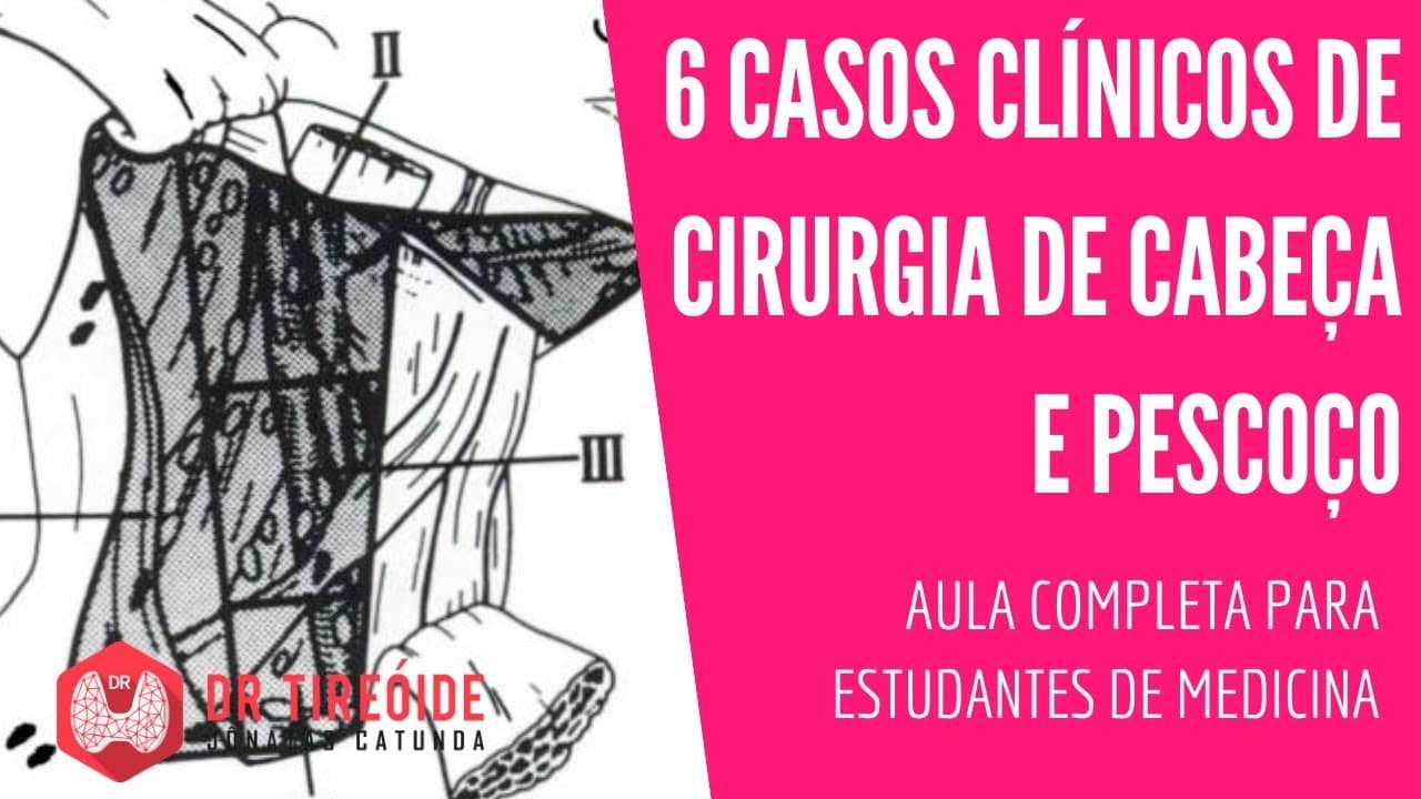 6 Casos clínicos de cirurgia de cabeça e pescoço - Aula para estudantes de Medicina