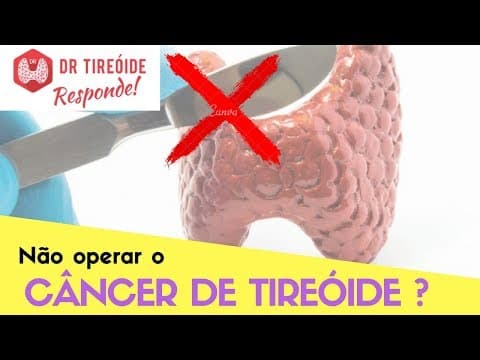 Não operar o câncer de tireóide? - Dr Tireóide Responde