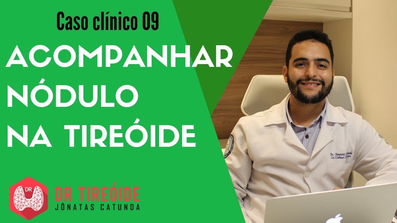Acompanhar nódulo na tireóide - Caso Clínico Dr Jônatas Catunda