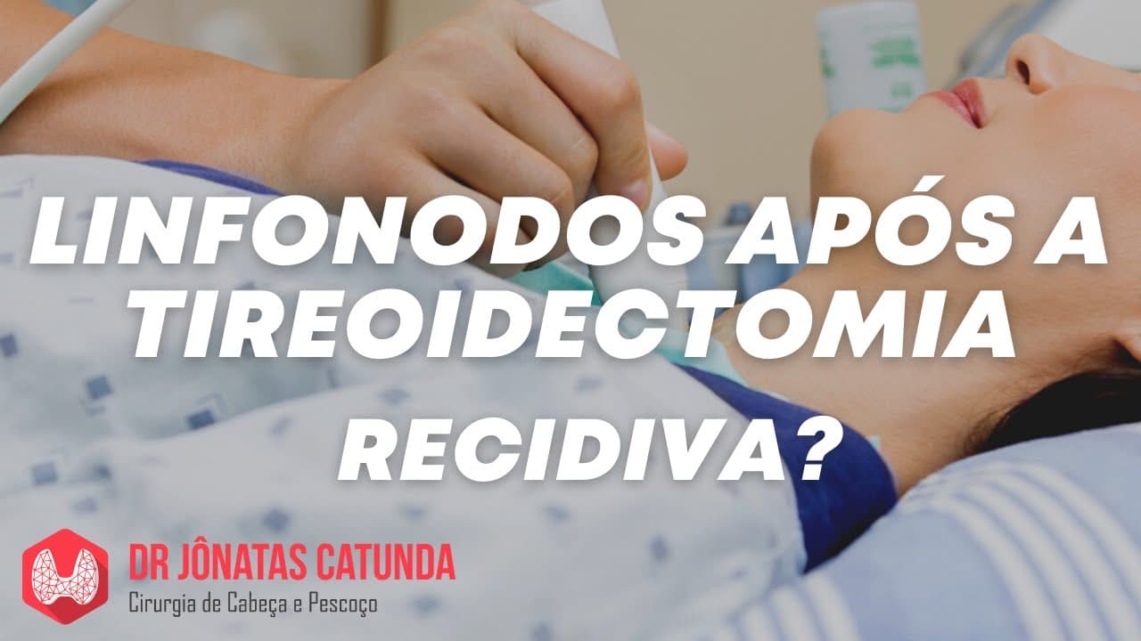 Câncer de tireoide: Linfonodo detectado no ultrassom - Recidiva?