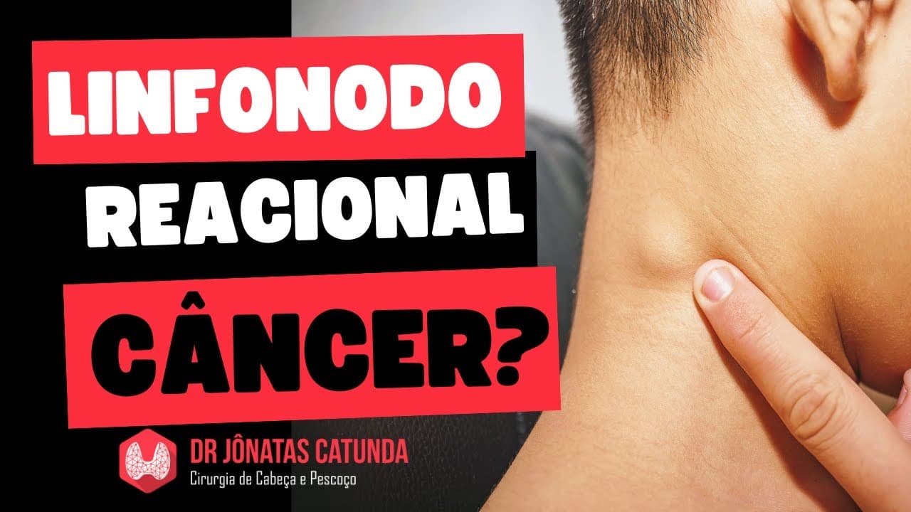 Linfonodo reacional: como saber se é câncer?