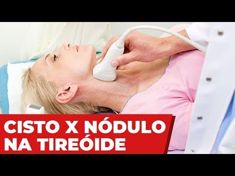 Diferença entre cisto e nódulo na tireoide - é perigoso?