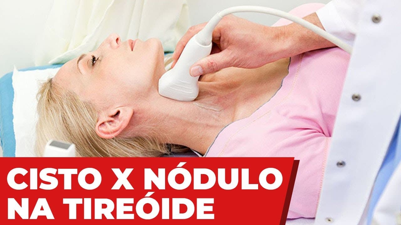 Diferença entre cisto e nódulo na tireoide - é perigoso?