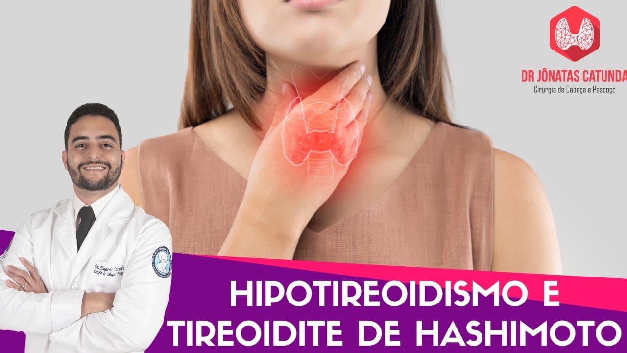 Hipotireoidismo e Tireoidite de Hashimoto