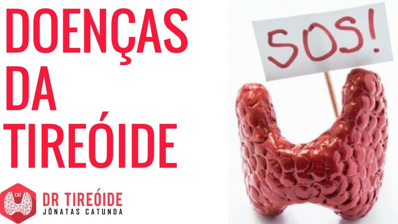 Quais são as doenças da tireoide? Existem tipos de tireóide? | Dr Jônatas Catunda