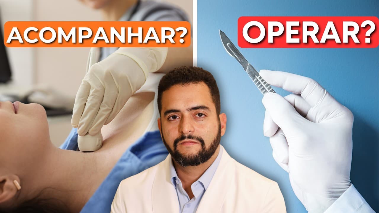 Nódulo na tireoide: quando acompanhar e quando operar | Dr. Jônatas Catunda