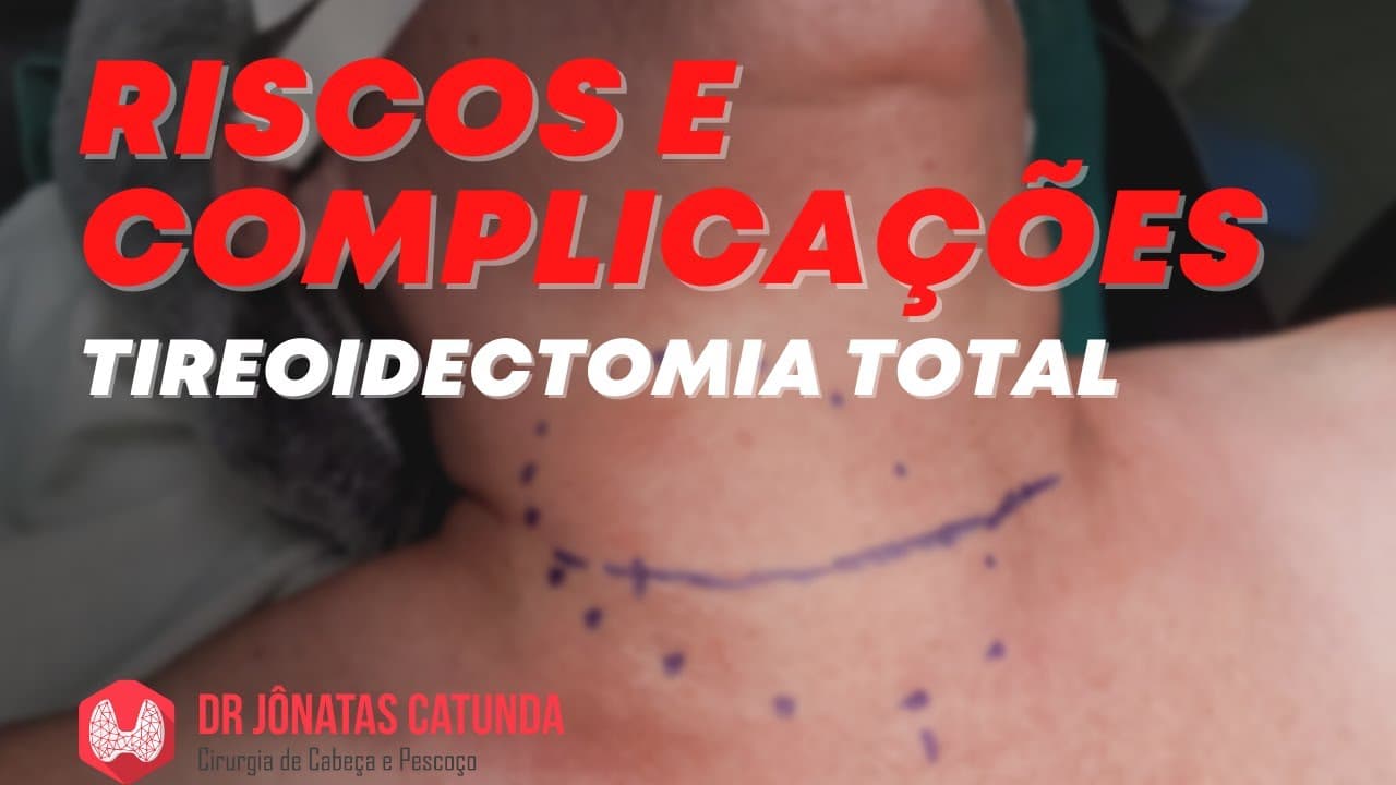 Tireoidectomia total é uma cirurgia perigosa? Riscos e complicações