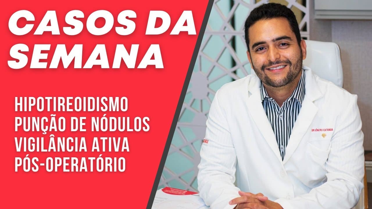 Casos da semana - Hipotireoidismo grave, Nódulo misto, Punção de pseudonódulo, Hipertensão x paaf