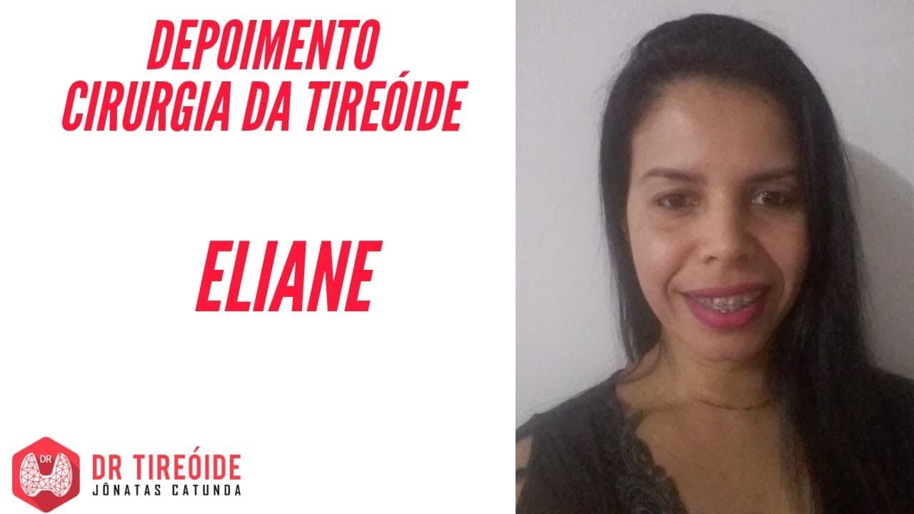 Depoimento Eliane - Tireoidectomia - Tireóide e eu