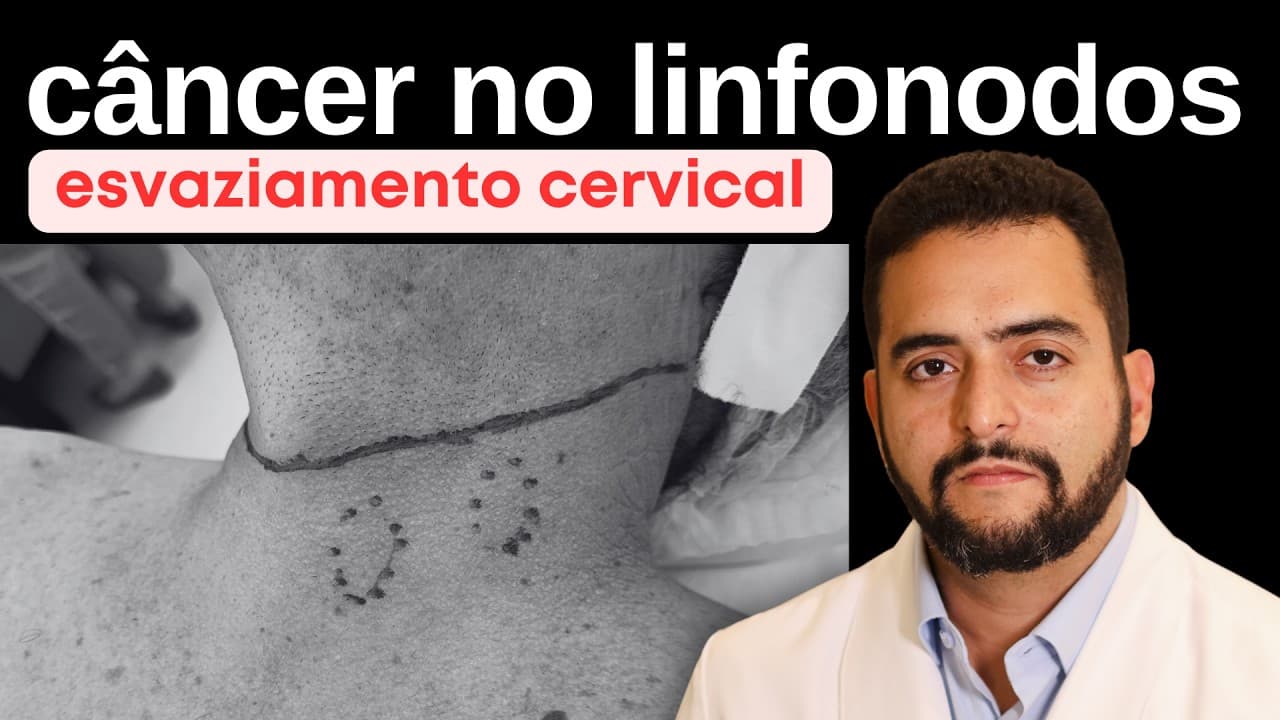 Esvaziamento cervical no câncer de tireoide: riscos, recuperação e quando é necessário