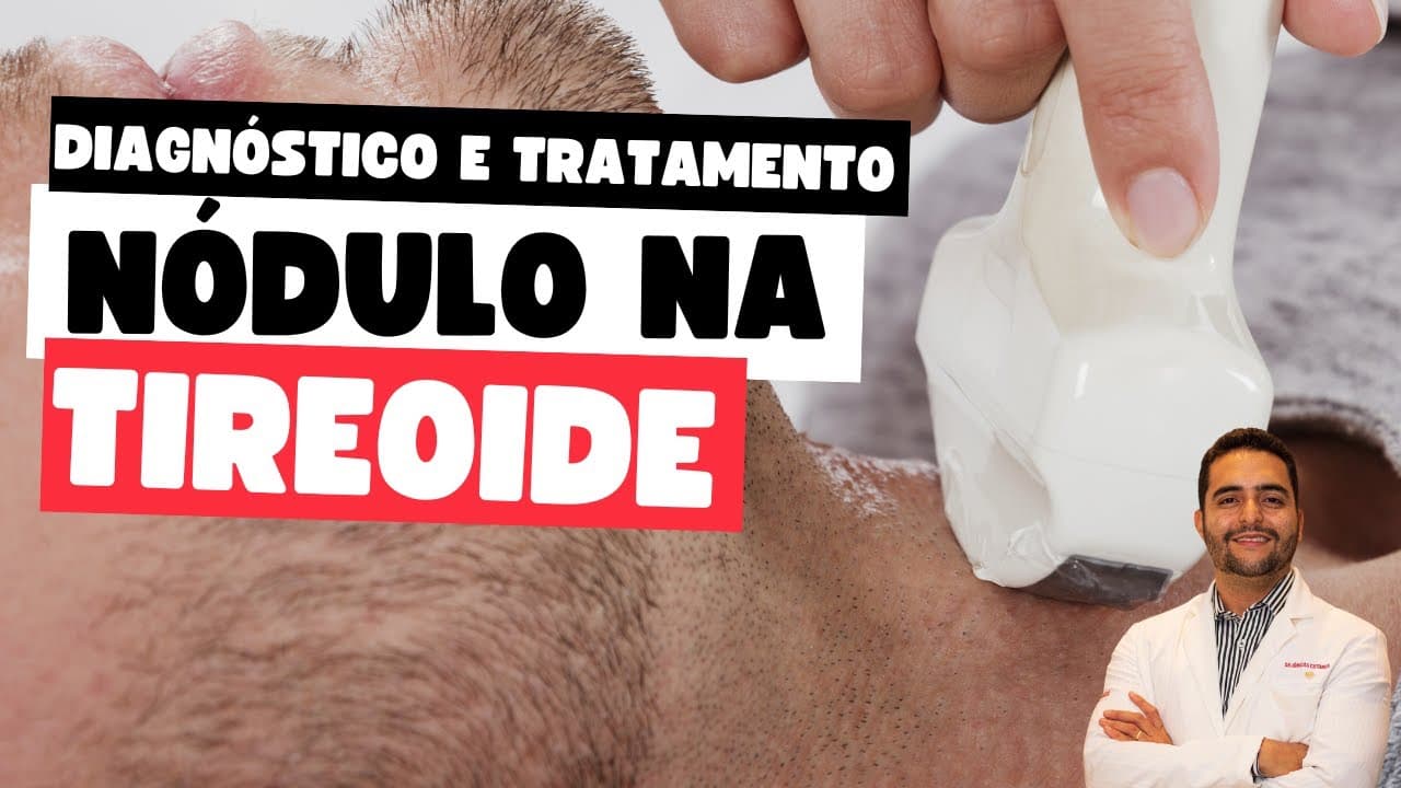 Nódulo na tireoide: como é o diagnostico e o tratamento