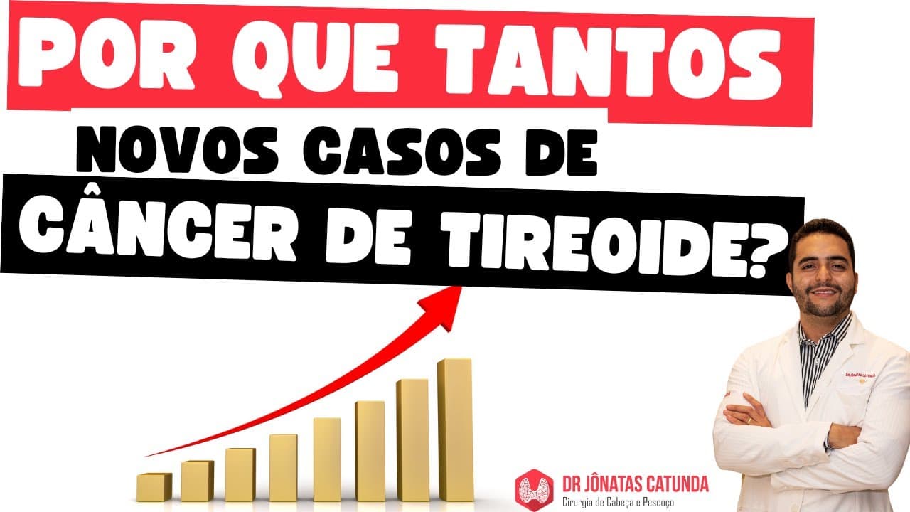 Epidemia de câncer de tireoide - motivos de tantos casos novos