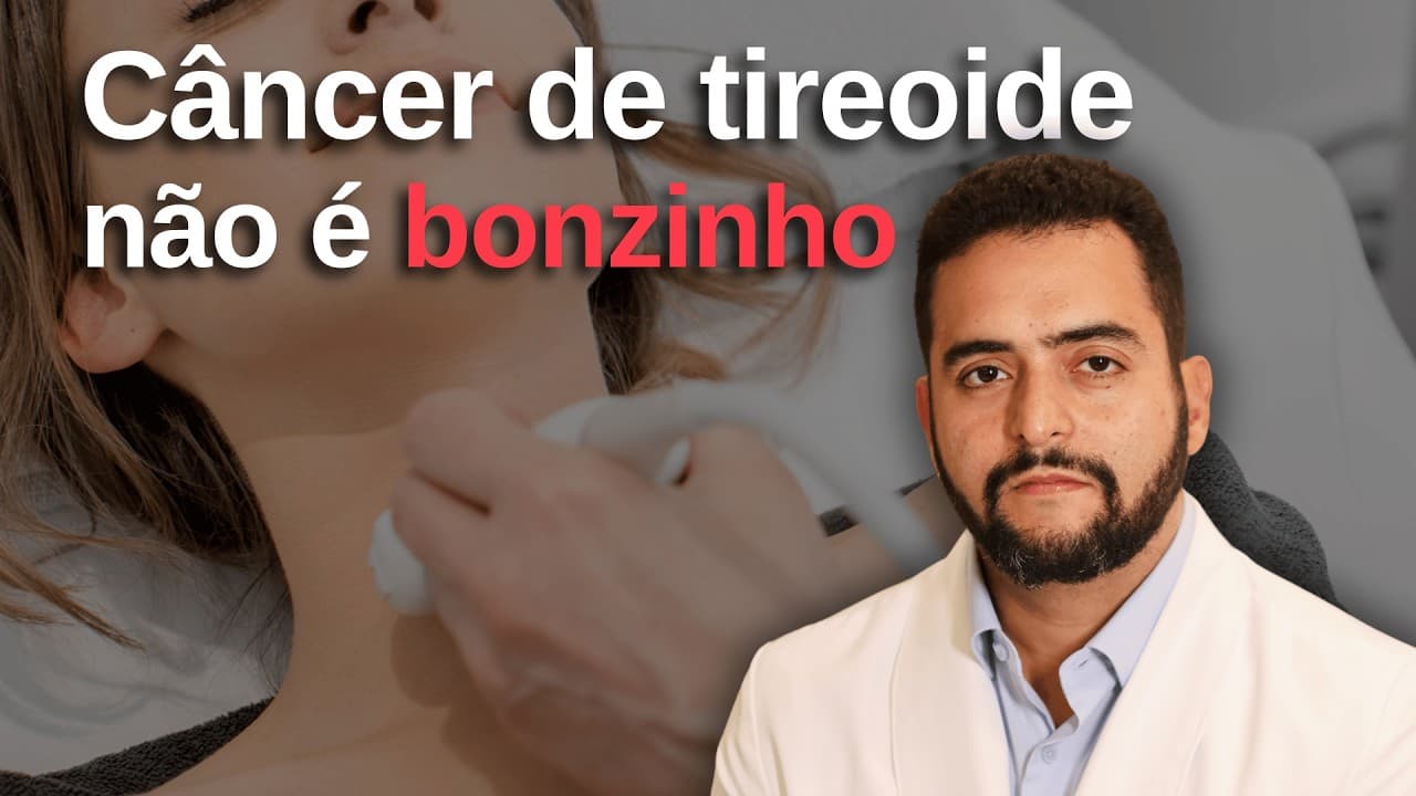 Câncer de tireoide NÃO é bonzinho