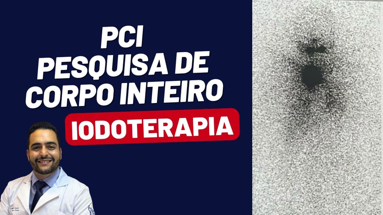 PCI - PESQUISA DE CORPO INTEIRO / RADIOIODOTERAPIA NO CÂNCER DE TIREOIDE