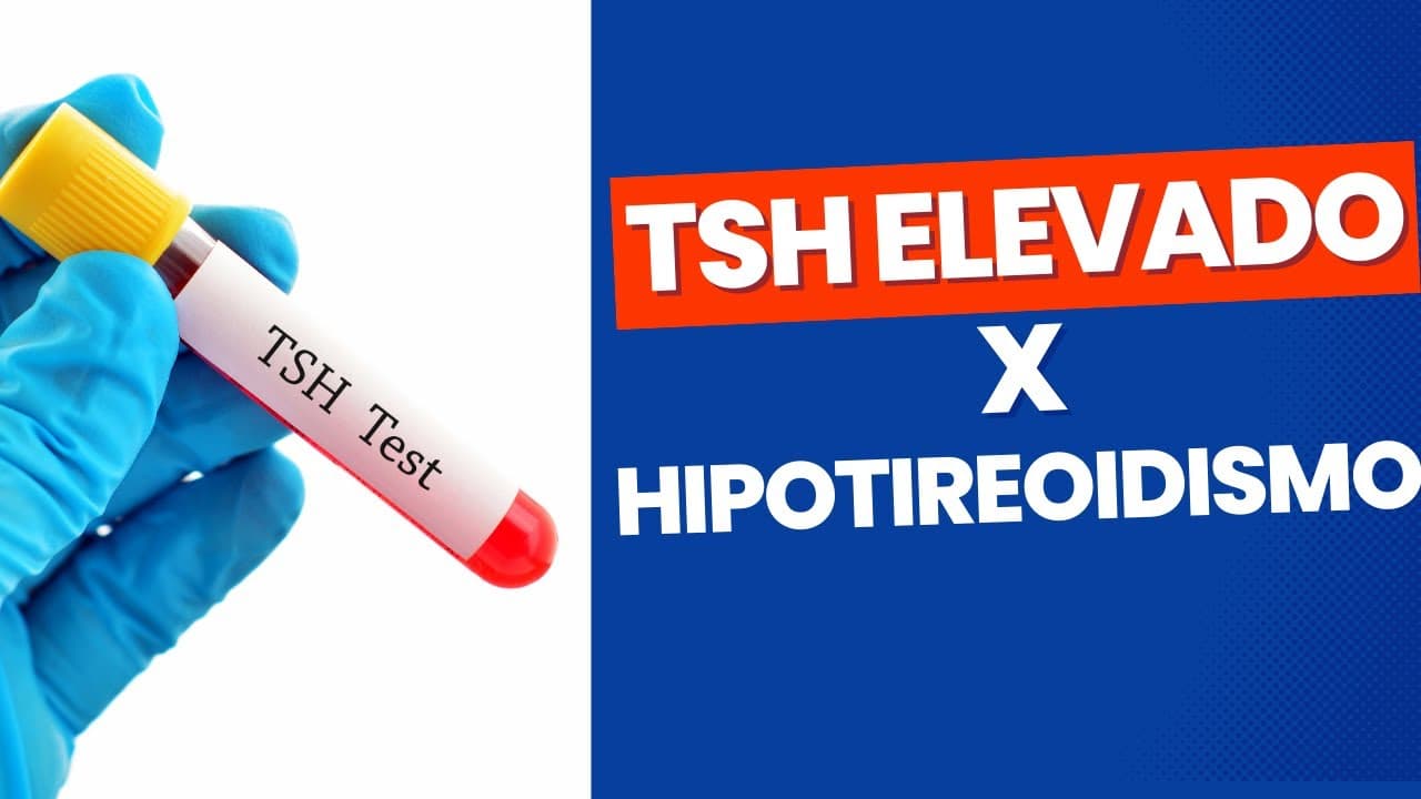 TSH elevado - Hipotireoidismo