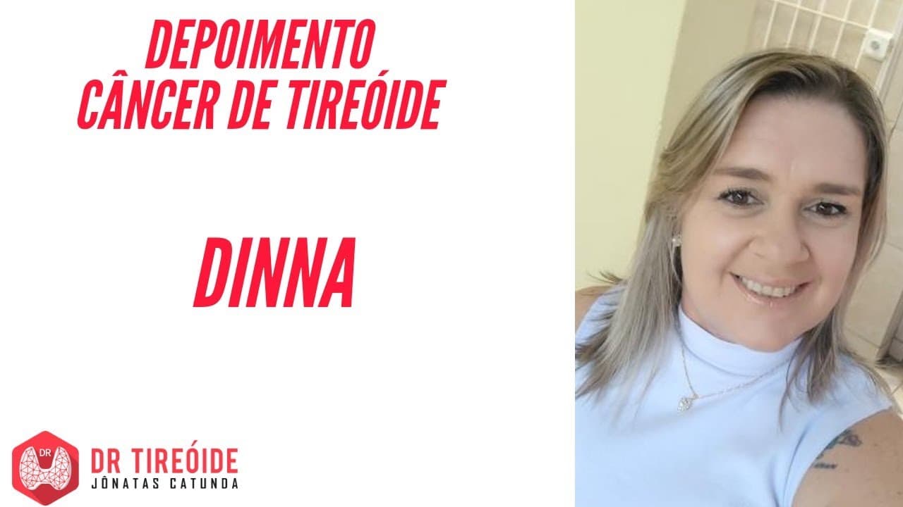 Tireóide e eu - Depoimento Dinna - Tireoidectomia, esvaziamento cervical lateral