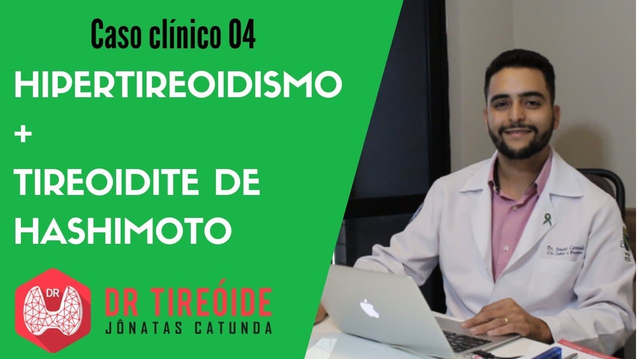 Hipertireoidismo causado por Tireoidite de Hashimoto - Caso clínico | Dr Jônatas Catunda