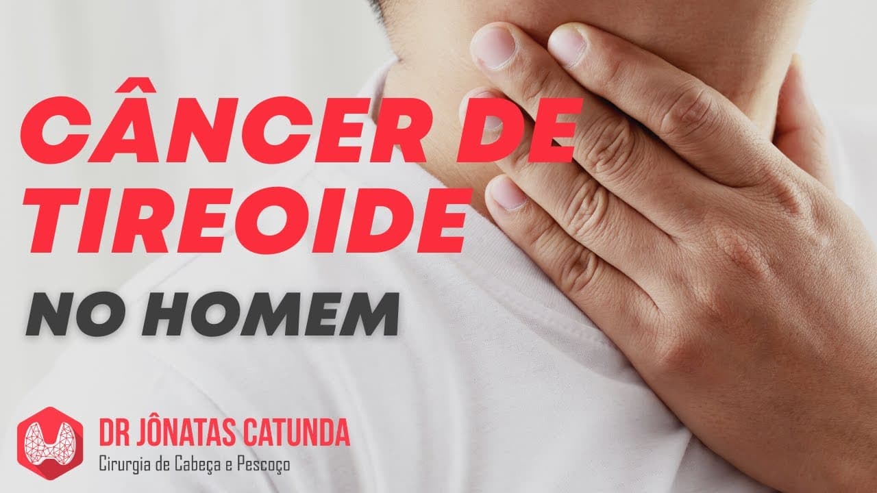 Câncer de tireoide no homem - Cada vez mais comum