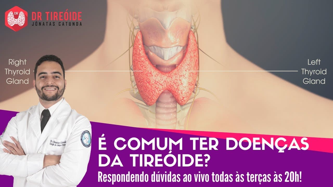 Você pode ter alguma doença da tireóide e ainda não saber! - Dr Tireóide responde