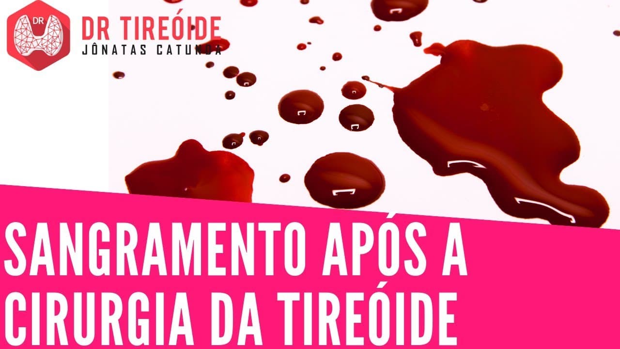 Sangramento e Hematoma após a cirurgia da tireóide | Dr Jônatas Catunda