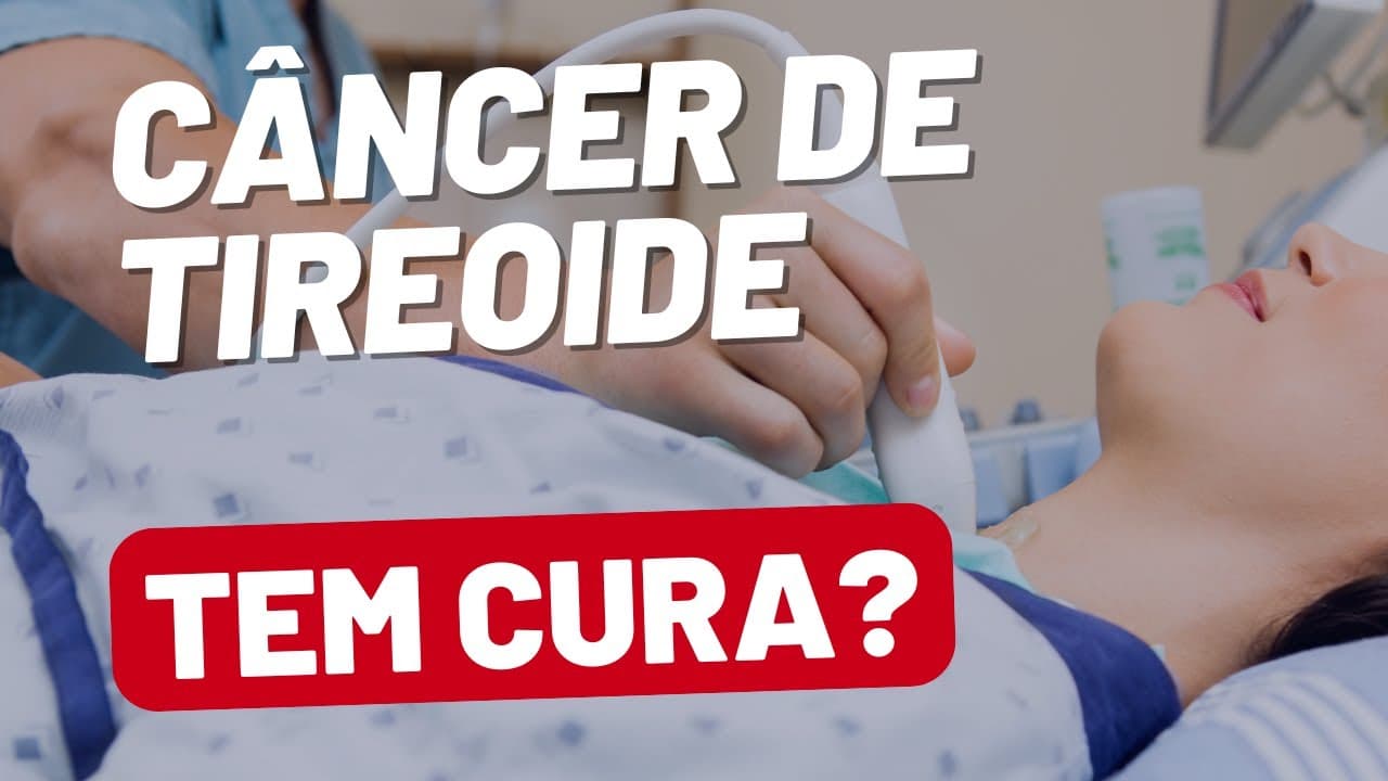 Câncer de tireoide tem cura? Quais as chances?