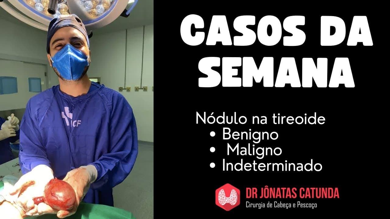 Casos da semana - nódulos na tireoide, benigno, maligno e indeterminado