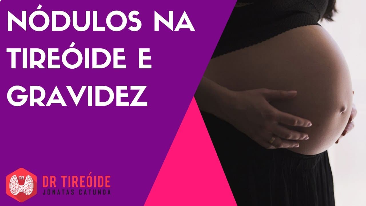 Nódulo na tireóide e gravidez | Dr Jônatas Catunda