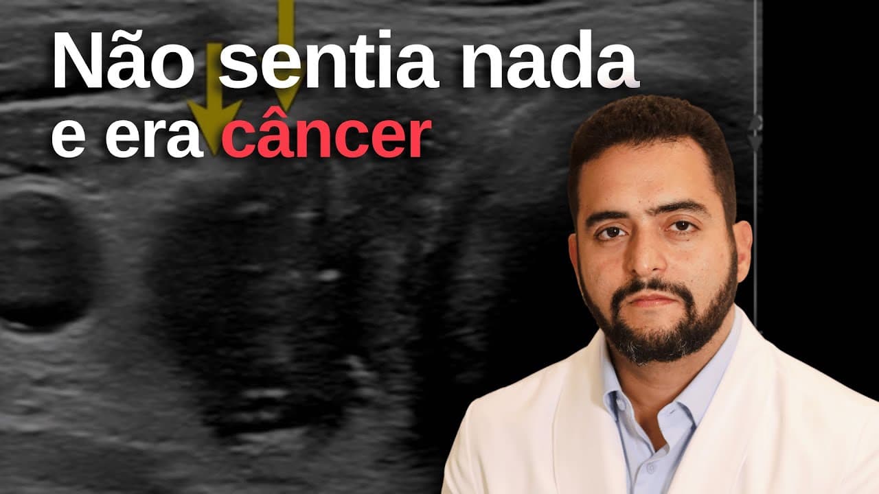Câncer de tireoide dá sintomas? Como ele costuma ser descoberto