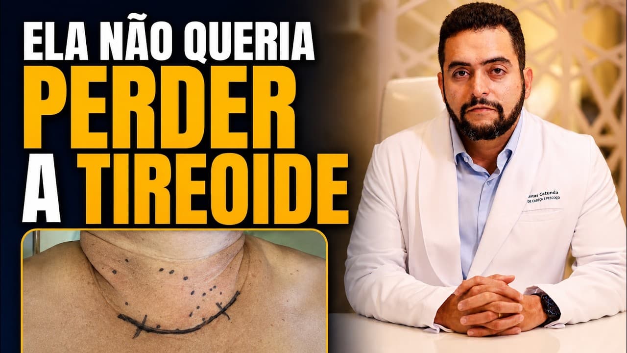 Nódulos benignos na tireoide: por que ela ainda precisou operar