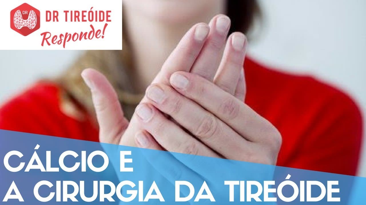Cálcio e a Cirurgia da tireóide - Dr Tireóide Responde