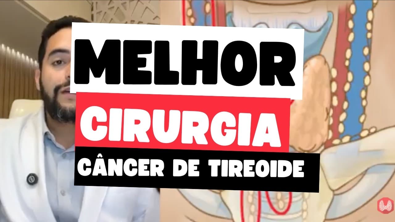 Tireoidectomia Total ou Parcial — Qual é a Melhor para o Câncer de Tireoide? | Dr. Jônatas Catunda