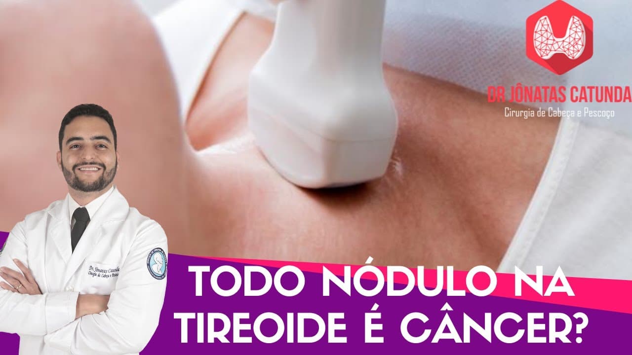 Todo nódulo na tireóide é maligno? Live respondendo perguntas