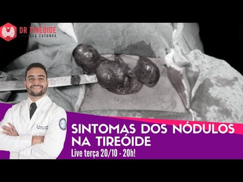 Sintomas dos nódulos na tireóide - LIVE Dr Tireóide responde