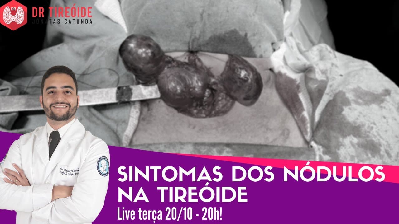 Sintomas dos nódulos na tireóide - LIVE Dr Tireóide responde
