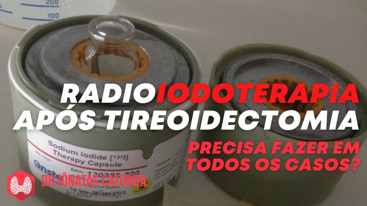 Radioiodoterapia no câncer de tireoide: todos os casos tem indicação?