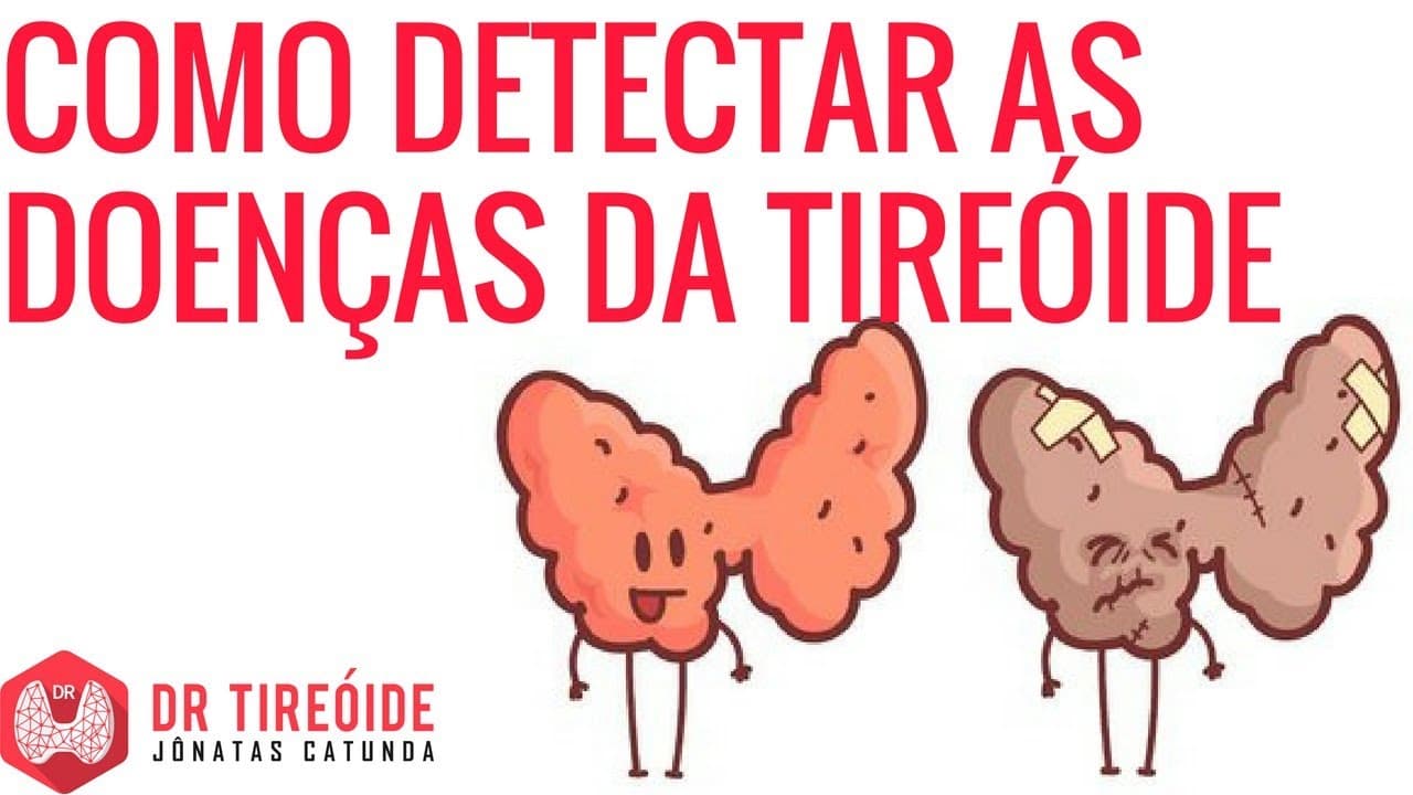 Como detectar as doenças da tireóide | Dr Jônatas Catunda