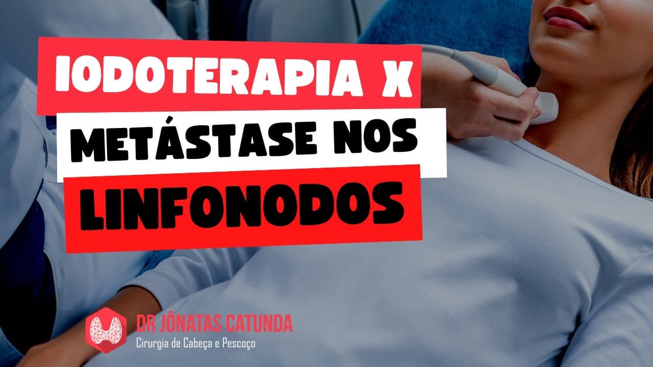 A iodoterapia combate metástases para os linfonodos no câncer de tireoide?
